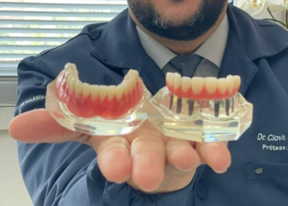 implante-dentario