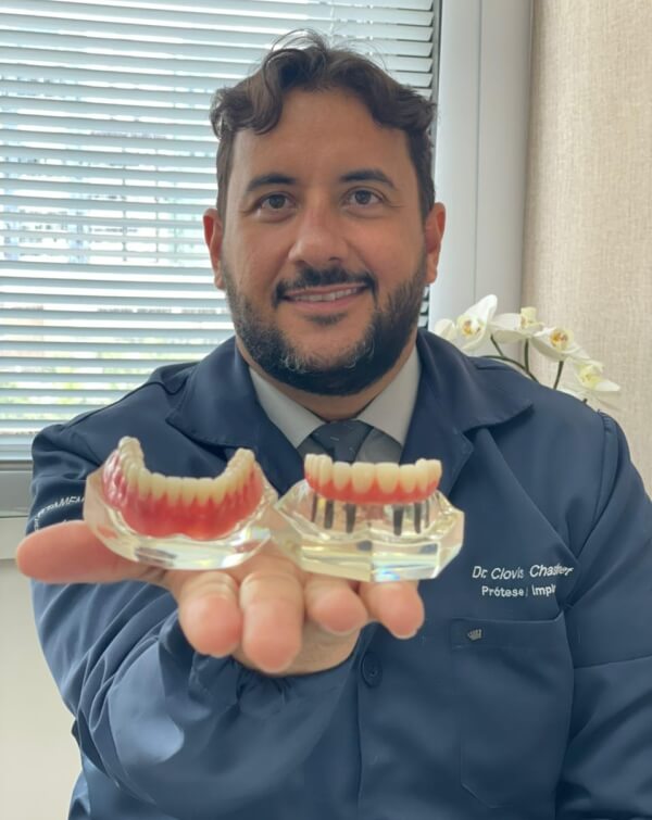 Implante dentário em Salvador