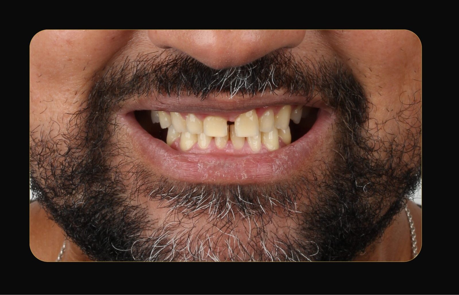 DR CLOVIS ANTES E DEPOIS (10)
