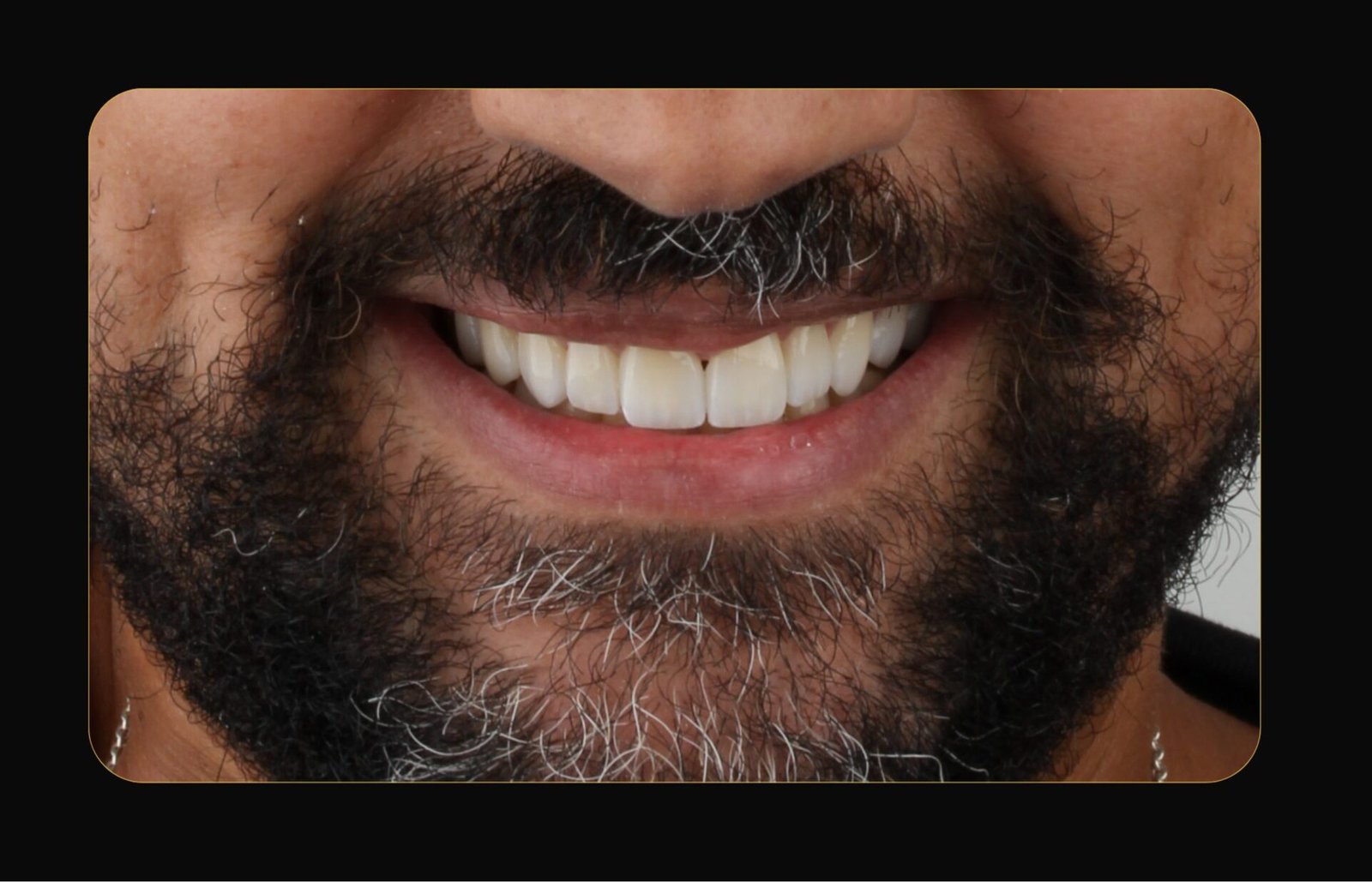 DR CLOVIS ANTES E DEPOIS (11)