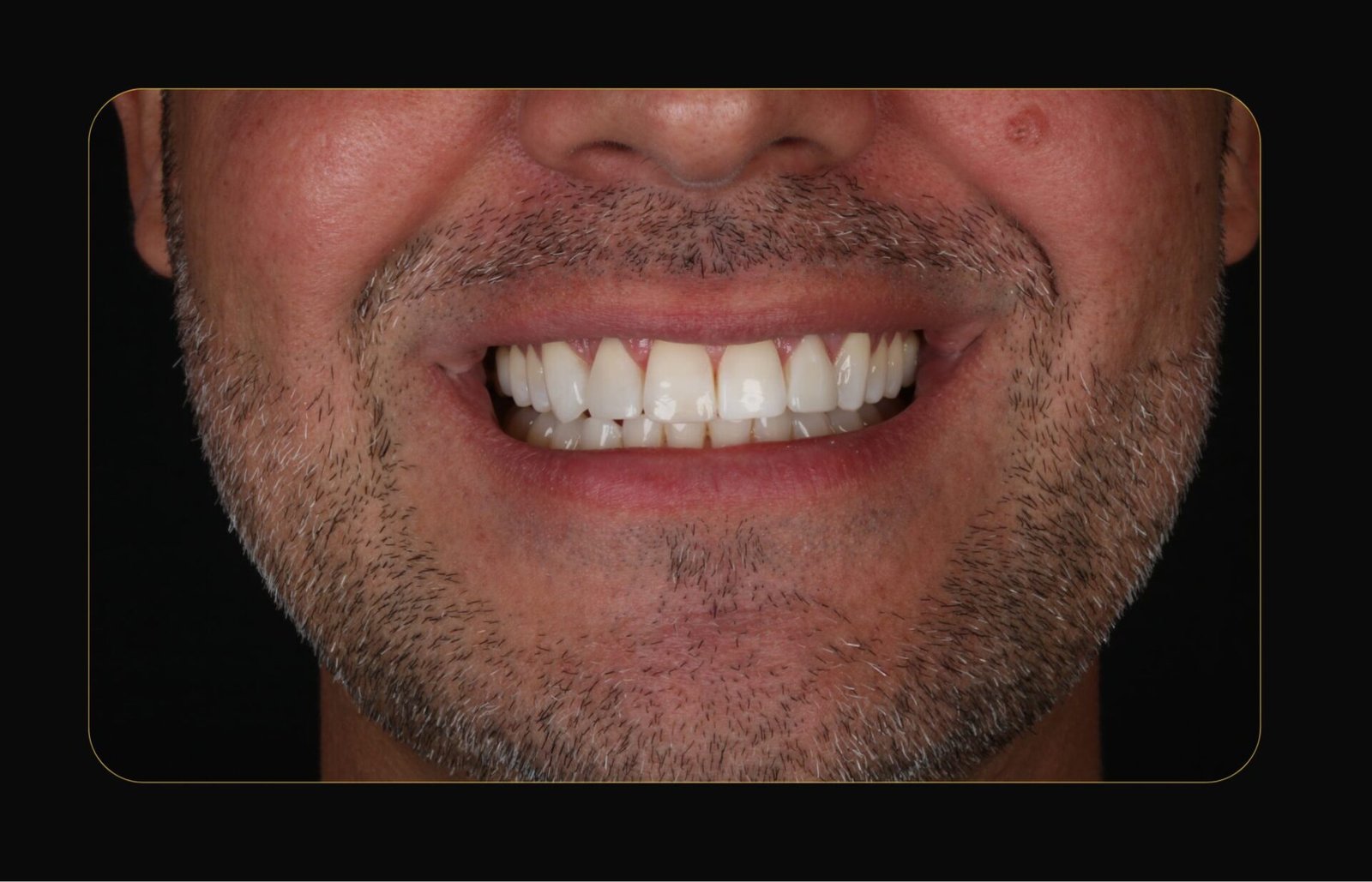 DR CLOVIS ANTES E DEPOIS (12)