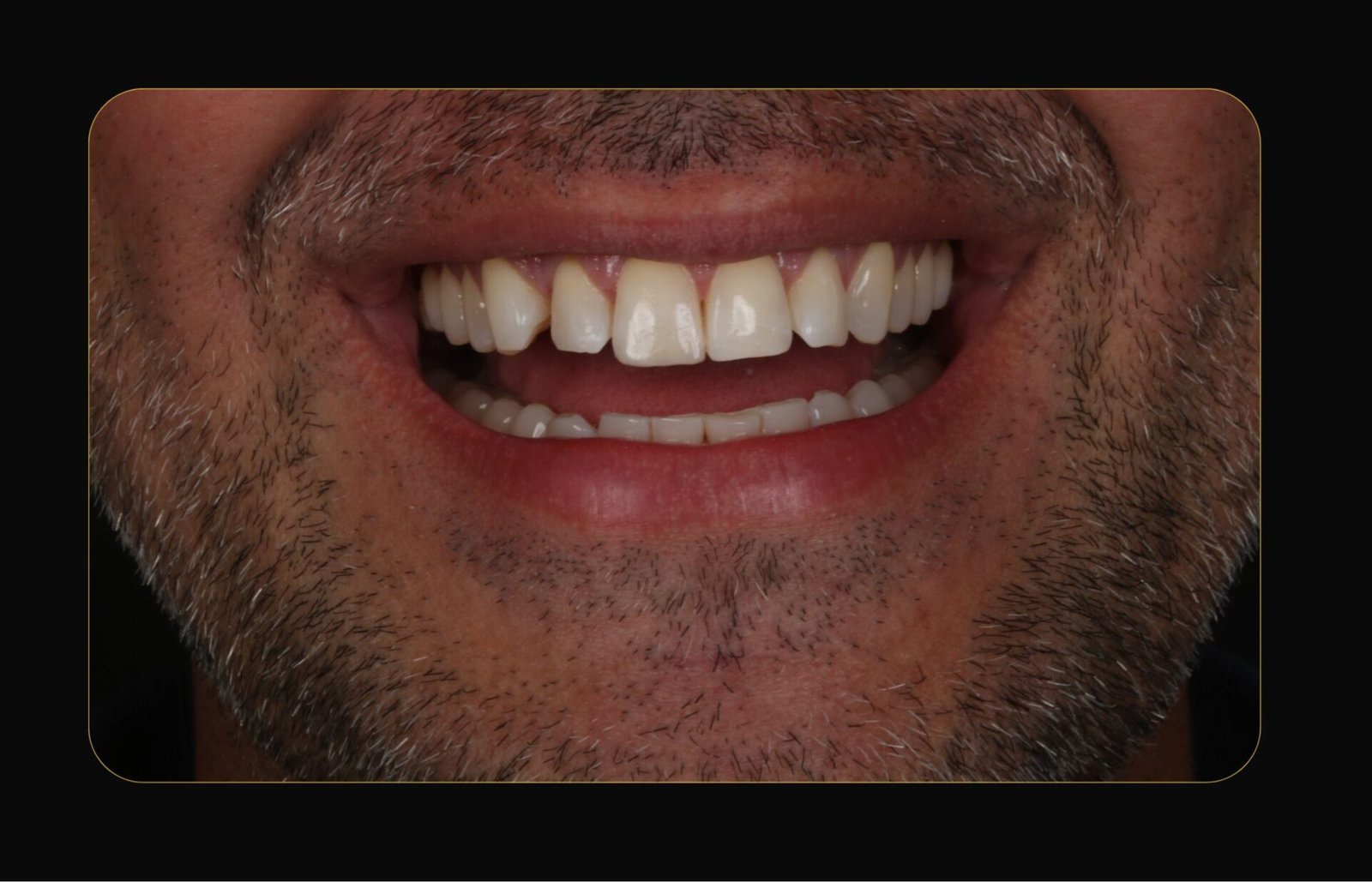 DR CLOVIS ANTES E DEPOIS (13)