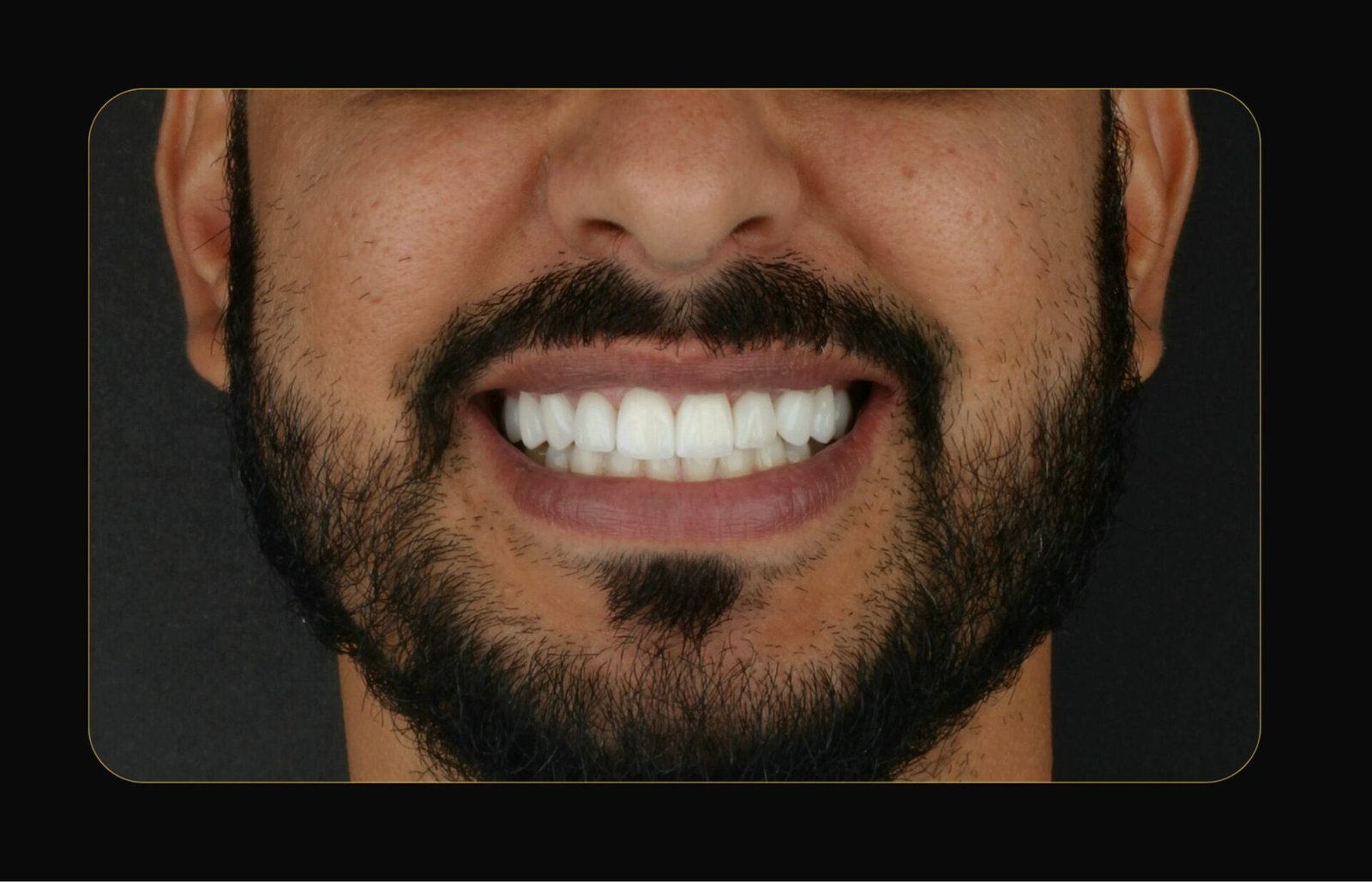 DR CLOVIS ANTES E DEPOIS (14)