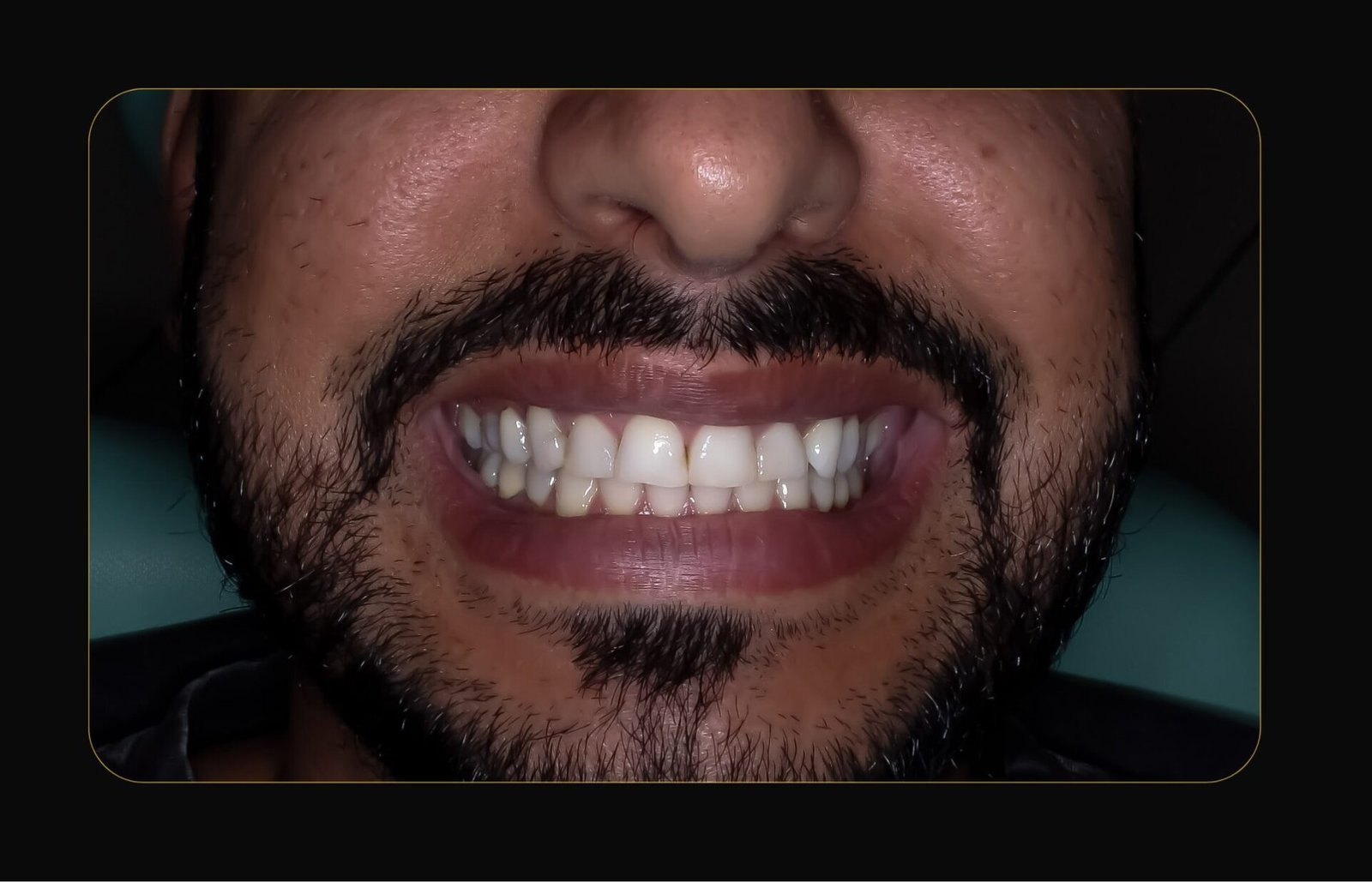 DR CLOVIS ANTES E DEPOIS (15)