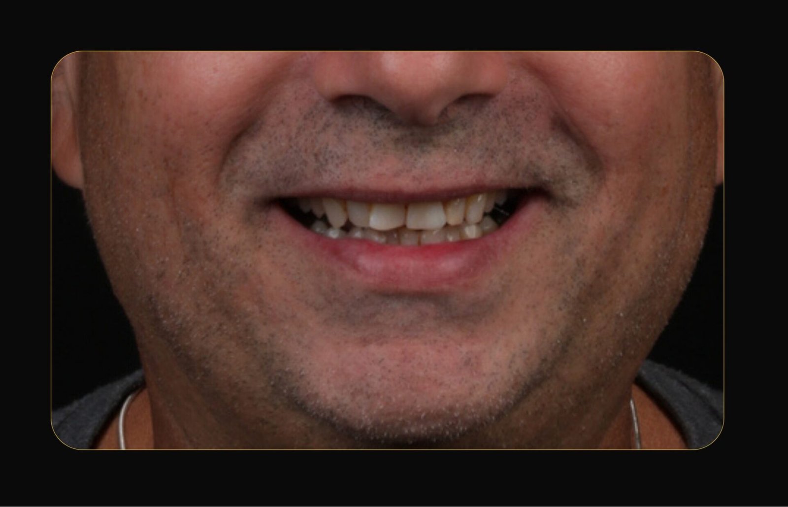 DR CLOVIS ANTES E DEPOIS (16)