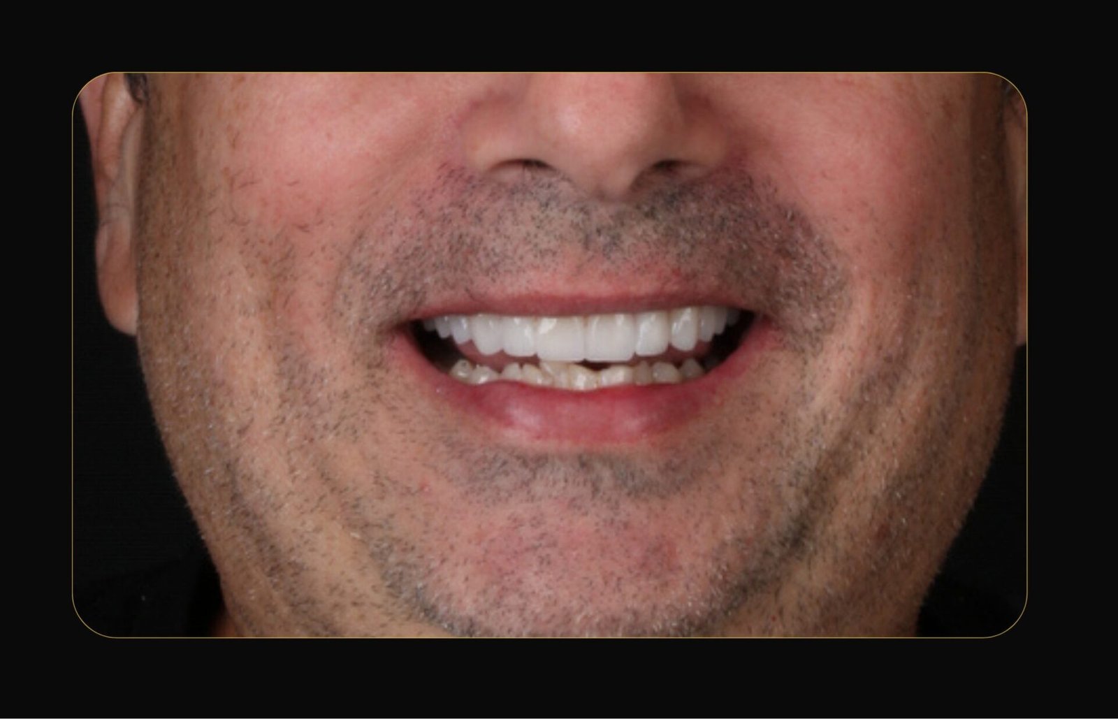 DR CLOVIS ANTES E DEPOIS (17)