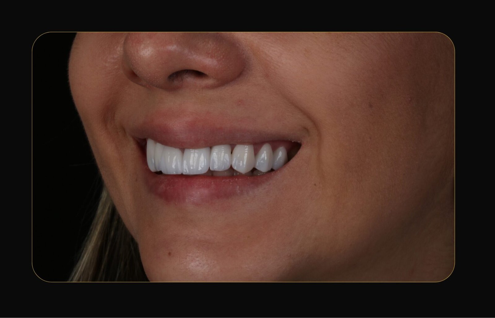DR CLOVIS ANTES E DEPOIS (3)