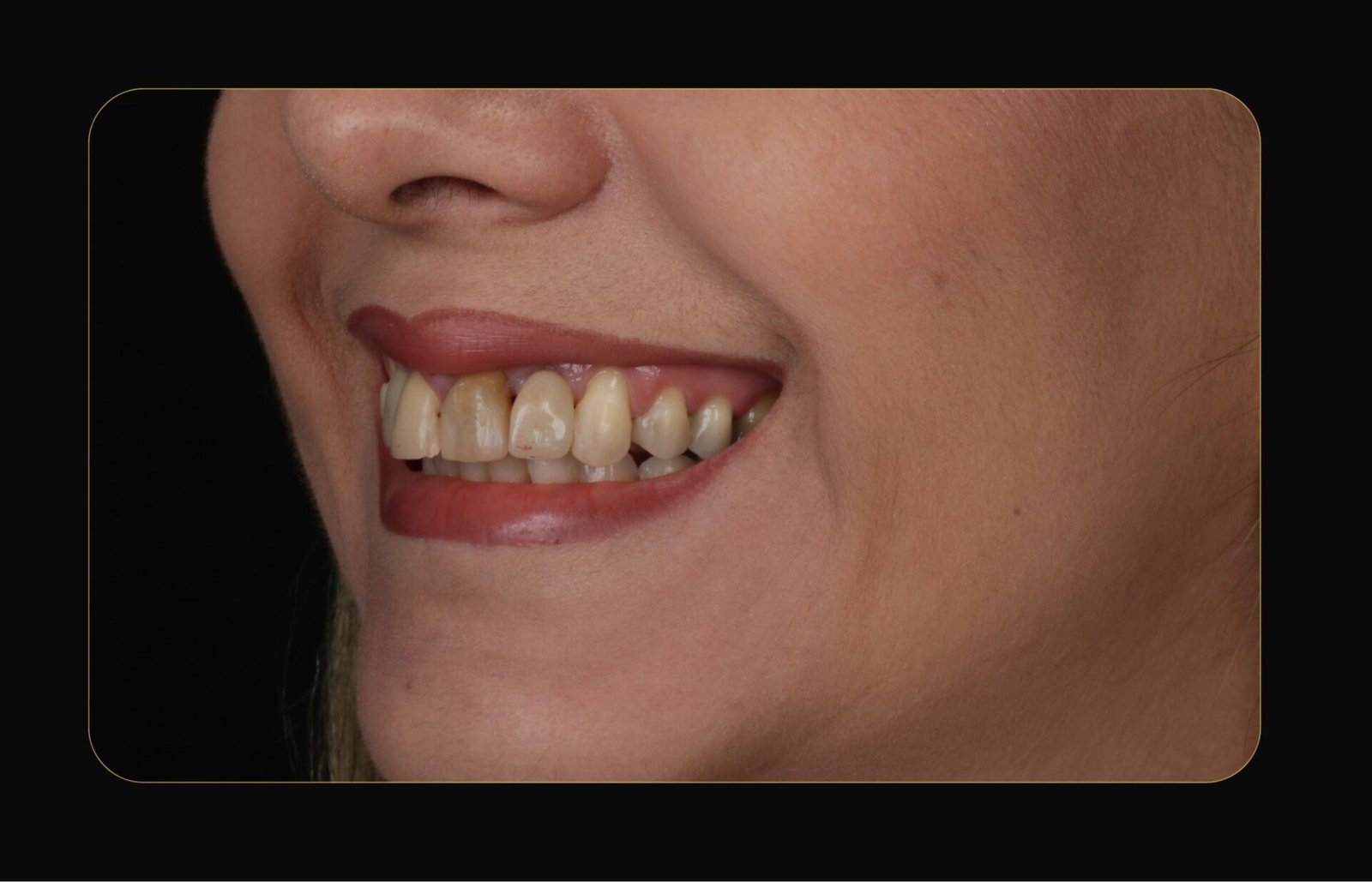 DR CLOVIS ANTES E DEPOIS (4)