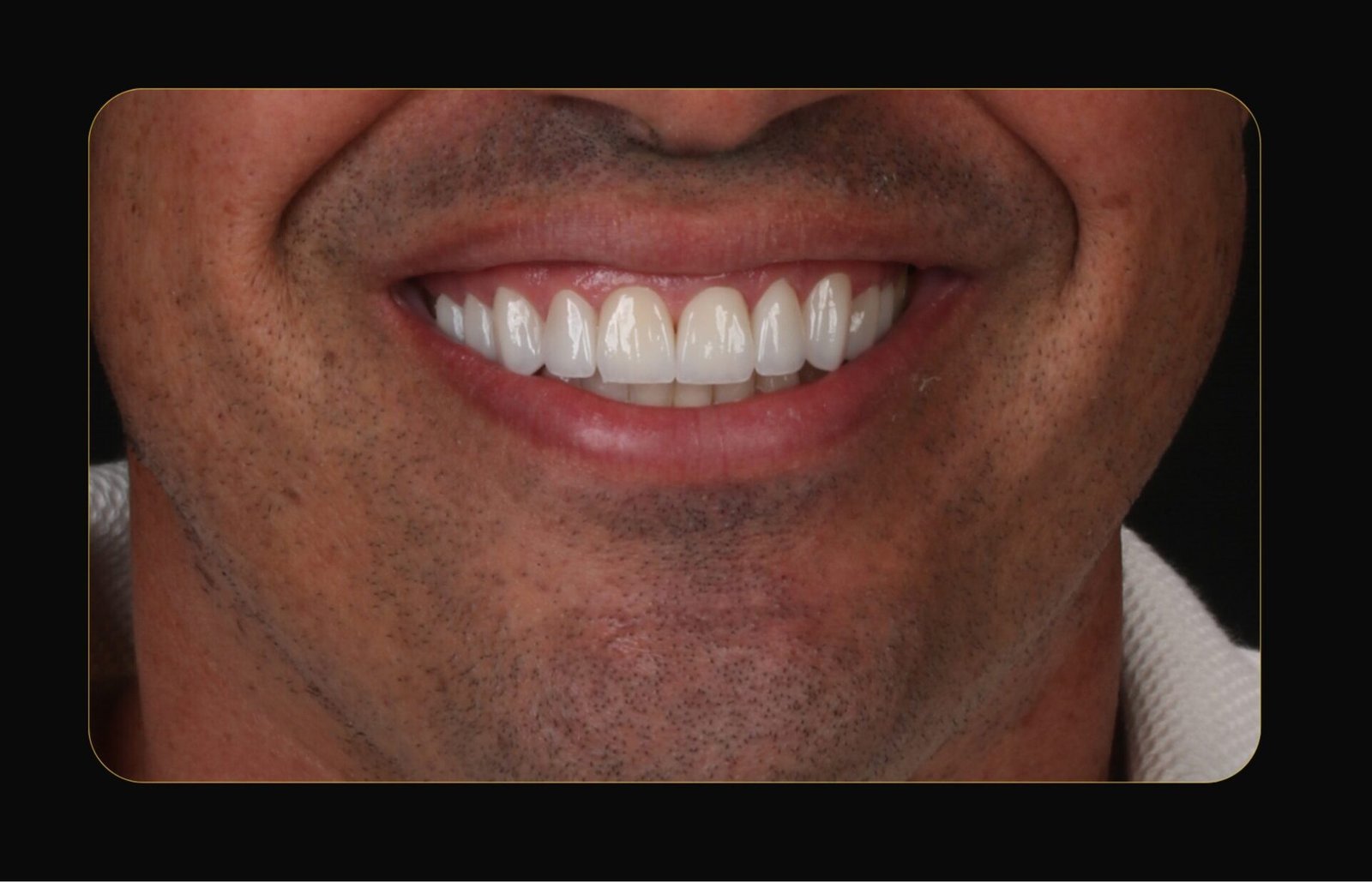 DR CLOVIS ANTES E DEPOIS (9)